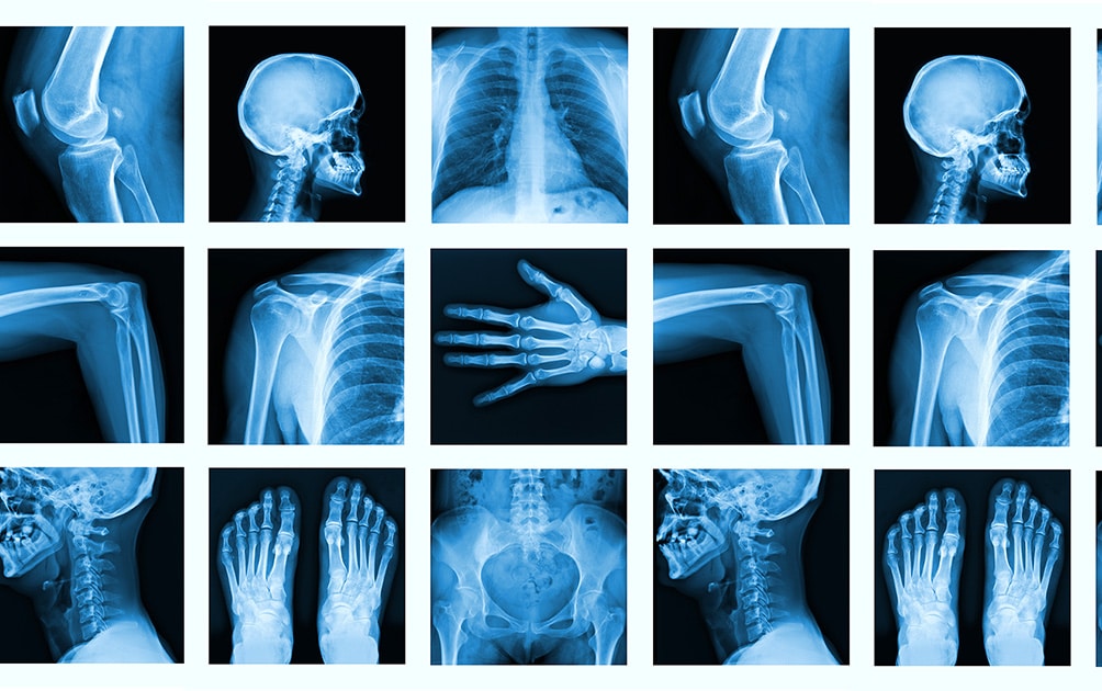 Your Bones on  KAATSU